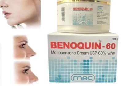 Benoquin-Cream-60-In-Pakistan-.-1